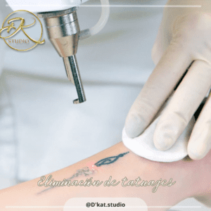 Dile adiós a los tatuajes no deseados y al vello no deseado en D'KAT Studio | Valle de los Chillos Dile adiós a los tatuajes no deseados y al vello no deseado en D'KAT Studio | Valle de los Chillos