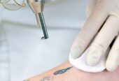 Dile adiós a los tatuajes no deseados y al vello no deseado en D’KAT Studio | Valle de los Chillos