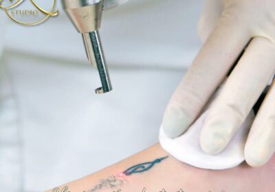 Dile adiós a los tatuajes no deseados y al vello no deseado en D'KAT Studio | Valle de los Chillos dkat-studio-00003