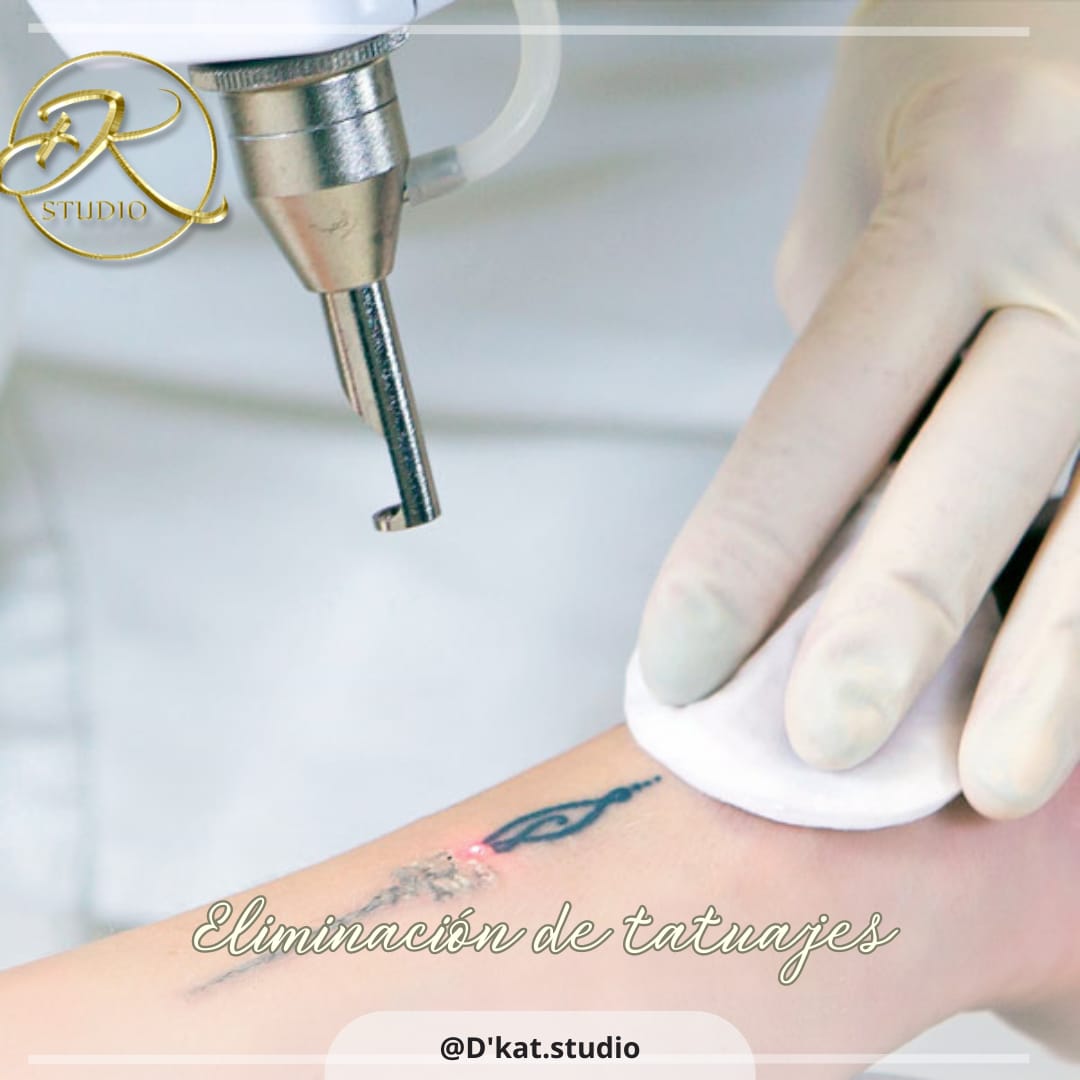 Dile adiós a los tatuajes no deseados y al vello no deseado en D’KAT Studio | Valle de los Chillos